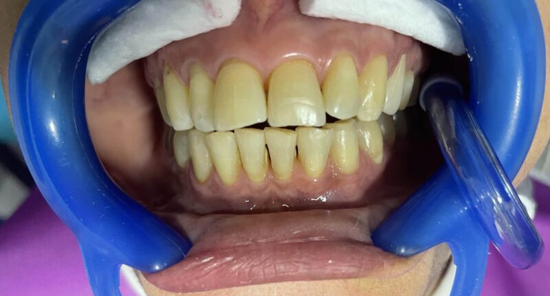 alt=“img cirugía oral 2”