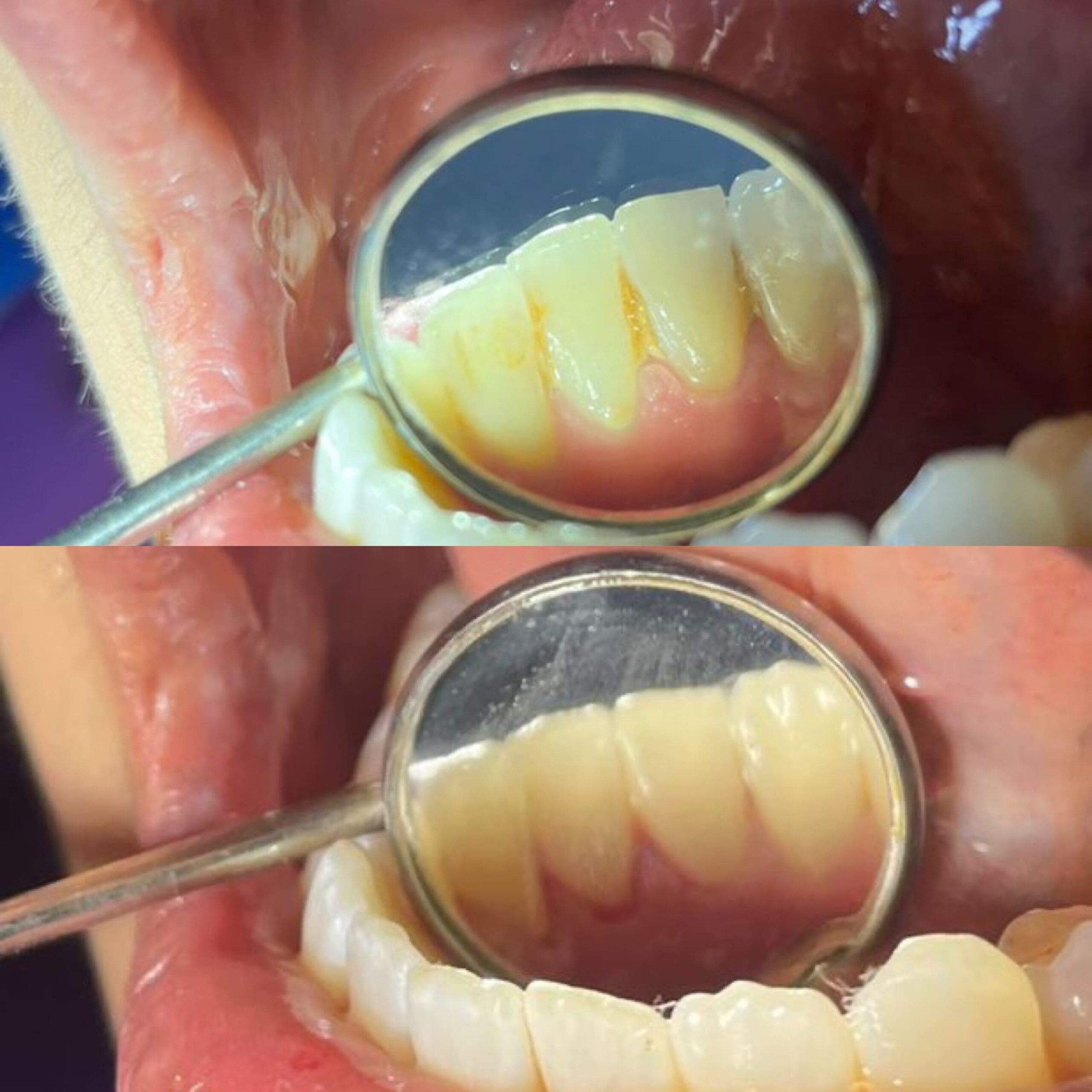 alt=“img Odontología General Cartagena”